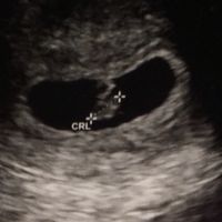 Semana 6 vaginal