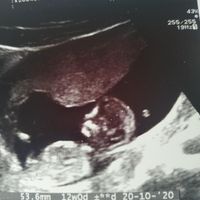 Futuras mamas octubre 2020 - 1