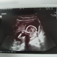 Futuras mamas octubre 2020 - 1