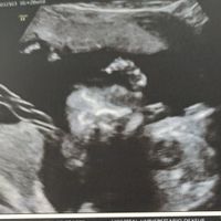 Futuras mamas octubre 2020 - 1