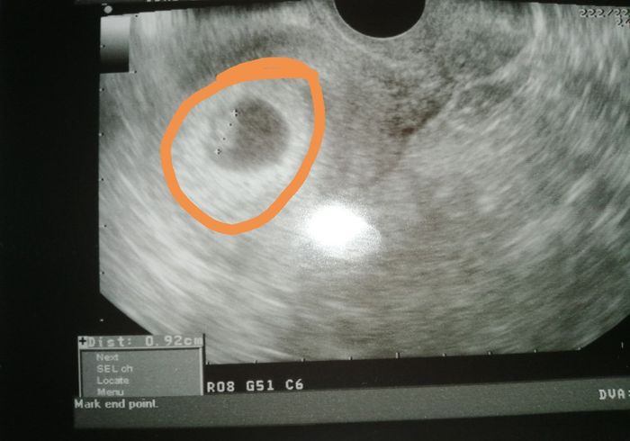 Futuras mamás Junio 2020 - 1
