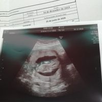 Futuras mamás Junio 2020 - 1