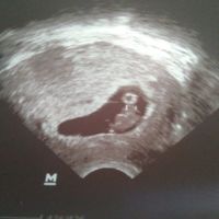 7semanas