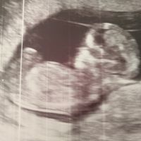  Futuras mamás Abril de 2018! - 1