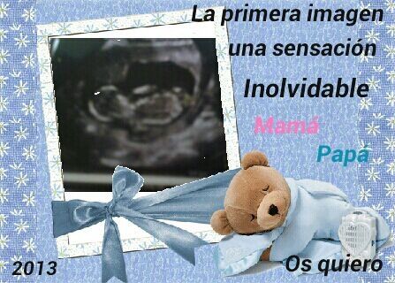 ECOGRAFIA