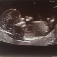Futuras mamis Enero 2022 - 1