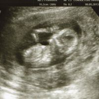 14 semanas