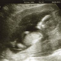 14 semanas
