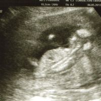 14 semanas