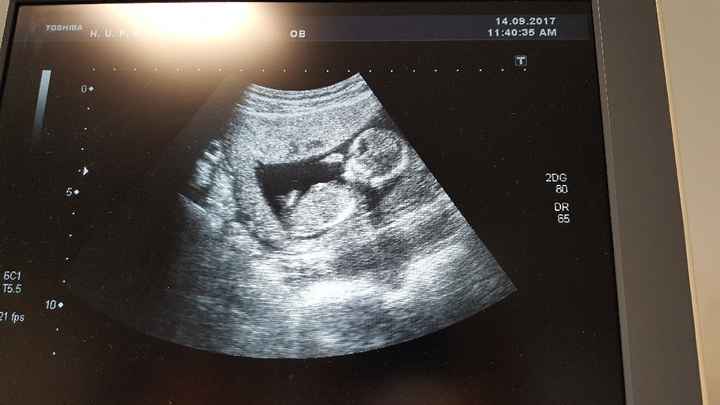  Niño o niña?? - 2
