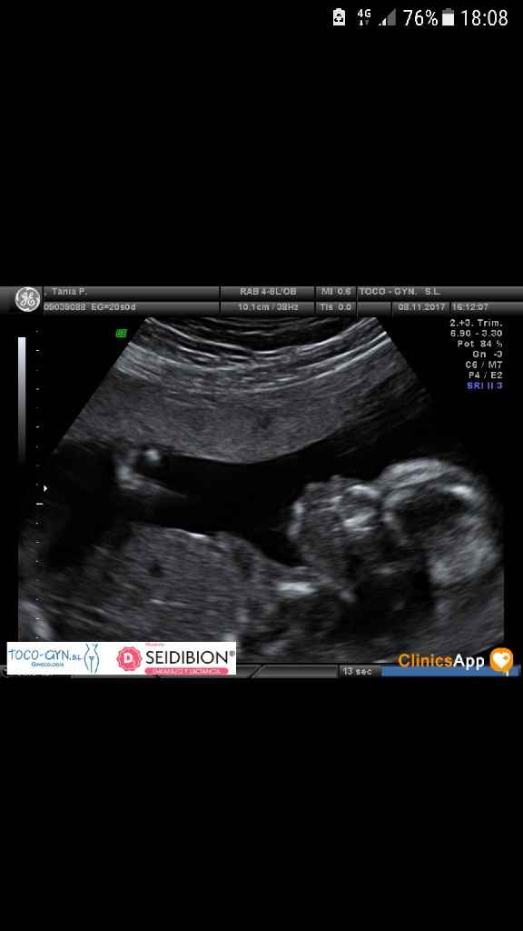 ¡nuevo! futuras mamis marzo 2018 - 1