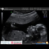 ¡nuevo! futuras mamis marzo 2018 - 1