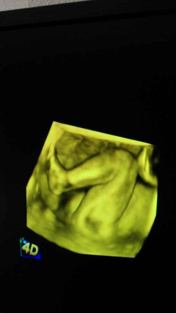 Futuras mamas septiembre 2016 - 2