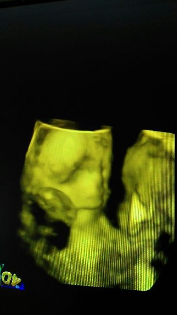 Futuras mamas septiembre 2016 - 1