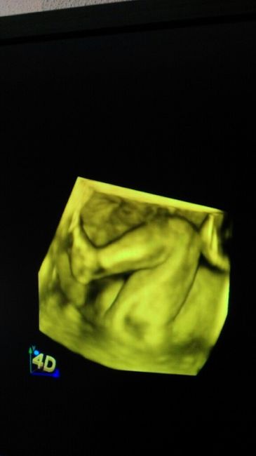 Futuras mamas septiembre 2016 - 2