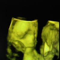 Futuras mamas septiembre 2016 - 1