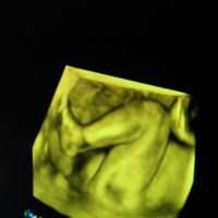 Futuras mamas septiembre 2016 - 2