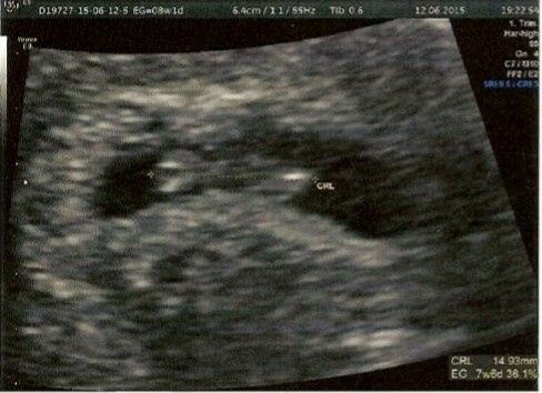 Mamis enero 2016 - 1
