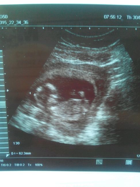 Mamis enero 2016 - 1