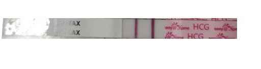 ia inseminacion artificial - 1