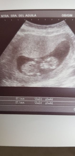 Ayuda con método ramzi: niño o niña? 4