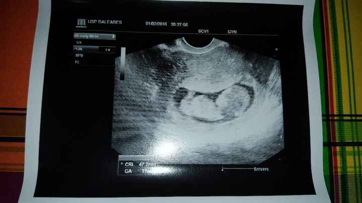 ¡¡futuras mamás agosto 2016!! - 1