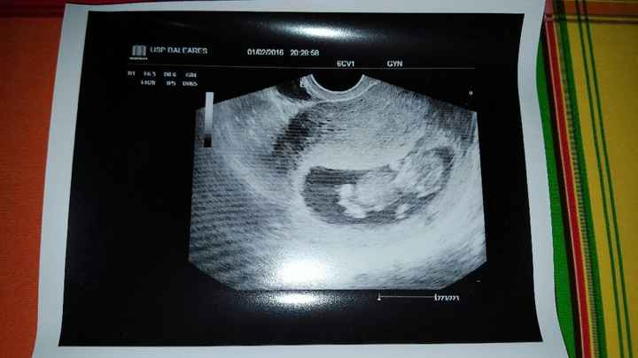 ¡¡futuras mamás agosto 2016!! - 2