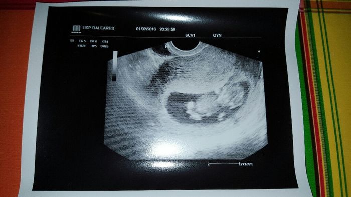 ¡¡futuras mamás agosto 2016!! - 2