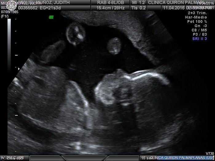 bebe 21 semanas
