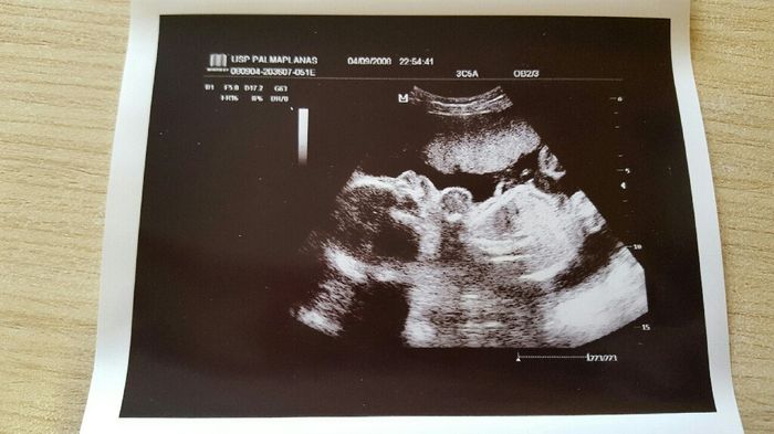 ¡¡futuras mamás agosto 2016!! - 2