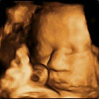 ¡¡futuras mamás agosto 2016!! - 1