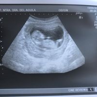 ¡nuevo! futuras mamis marzo 2018 - 1