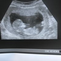 ¡nuevo! futuras mamis marzo 2018 - 2