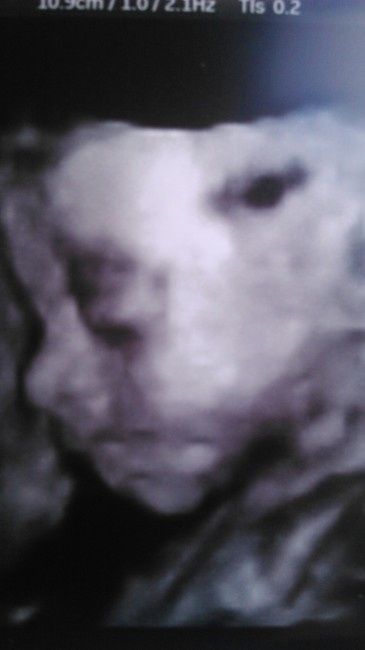 mi chiquitina