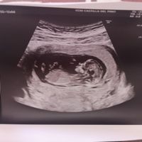 Ayuda con método ramzi: niño o niña? - 1
