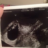 Futuras mamas julio 2019 - 1