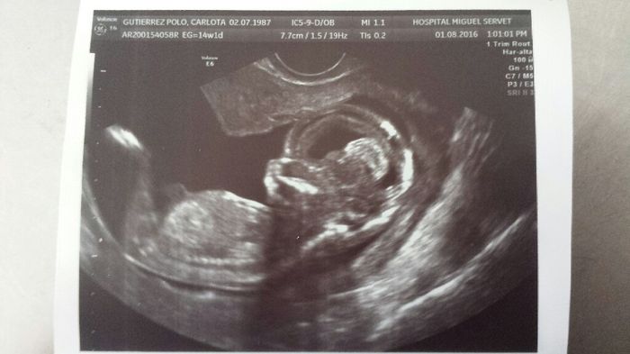Futuras mamas febrero 2017 - 1