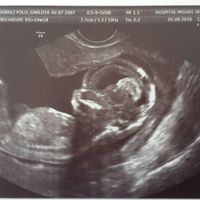 Futuras mamas febrero 2017 - 1