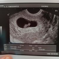 Ayuda con método ramzi: niño o niña? - 1