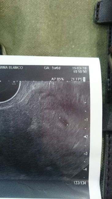 Futuras mamás Noviembre 2018! - 1