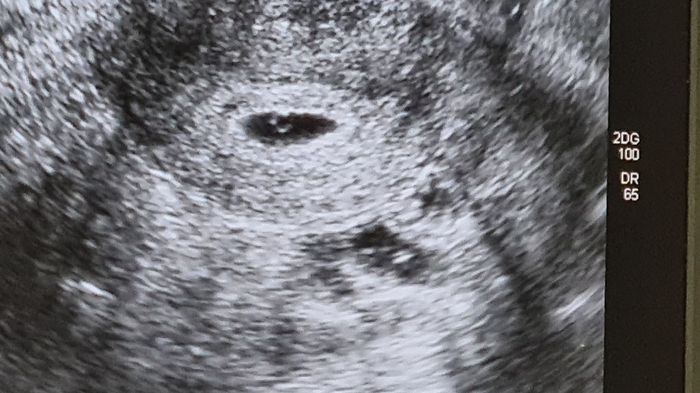 Futuras mamis junio 2021 🤰🏻❤️ oficial - 1
