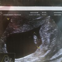 Futuras Mamis Enero 2021 - 1