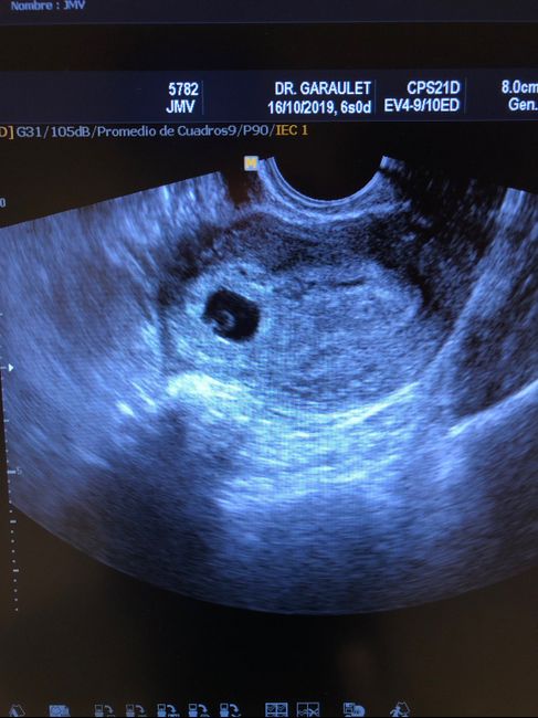 Futuras Mamas Julio 2020. - 2