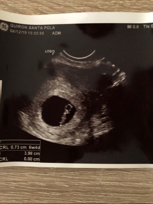Futuras Mamas Julio 2020. - 1