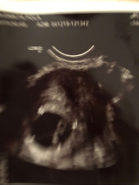 Futuras Mamas Julio 2020. - 2