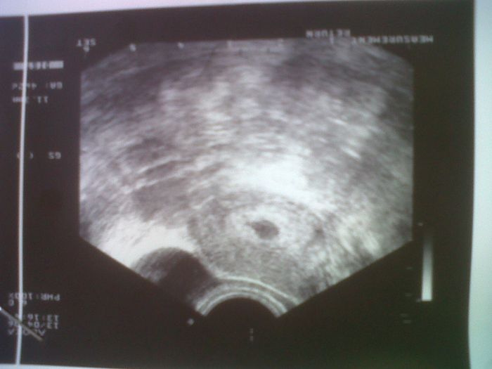 Primera ECO