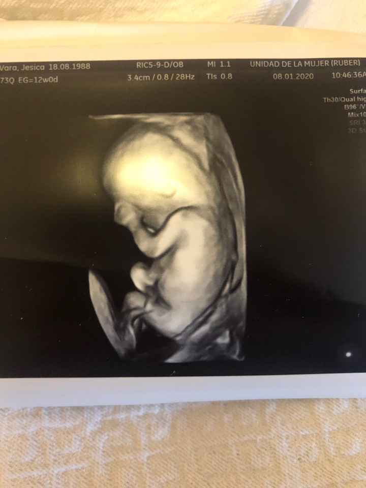 Futuras Mamas Julio 2020. - 1