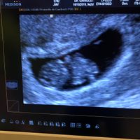 Futuras Mamas Julio 2020. - 1