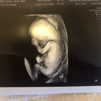 Futuras Mamas Julio 2020. - 2