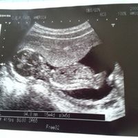El consultorio de Lita para futuras mamis - 2